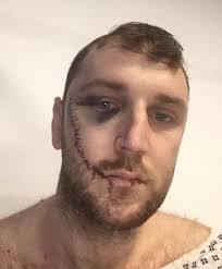 Slashed Everton fan admits he 'can't look at himself in the mirror'| All  Football