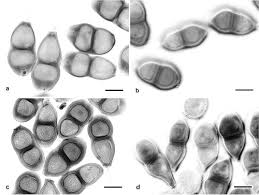 Image result for Berkheya bipinnatifida