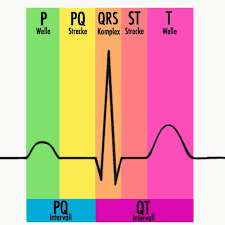 Qt Zeit Im Ekg Nebenwirkungen Von Medikamenten Cardiopraxis