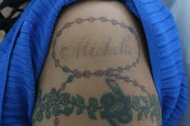 Rest easy — while laser tattoo removal can hurt, chances are it won't hurt as much as getting the tattoo did. Laser Tattoo Removal In Nyc Westchester Bronx By Studio Esthetique Tattoo Removal Center