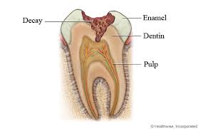 Perhaps we all have to experience tooth any chronic health problem may contribute to tooth decay and cavities. Can I Reverse A Cavity Memphis Dentist Blog