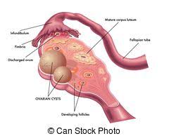 Image result for Cysta