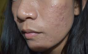 Your question might be answered by sellers, manufacturers, or customers who bought this product. Klavuu White Pearlsation Ideal Backstage Cream That Girl Coffee