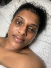 🧼 Bye Acne. Hello Confidence. 💙 You've tried everything… cleansers,  creams, harsh meds. But your acne still fights back? ✨ It's time for a skin  glow-up powered by NASA-backed technology. The