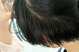 What Do Lice Look Like 20 Close Up Pictures Of Lice Pest Strategies