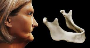 UNIVERSIDAD NACIONAL AUTÓNOMA DE MÉXICO ESCUELA NACIONAL DE ESTUDIOS  SUPERIORES UNIDAD LEÓN TÍTULO: REHABILITACIÓN BUCAL D