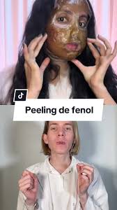 Peeling de fenol: ¿Te atreverías a probarlo?