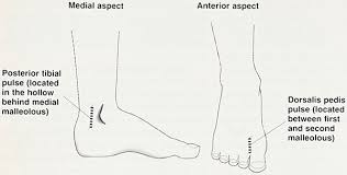 Leg Ulcer Assessment By Doppler Ultrasound