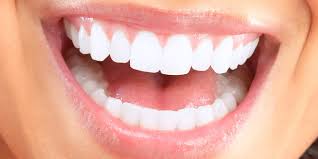 Gosok gigi saat puasa dengan odol (pasta gigi). Ini 7 Cara Memutihkan Gigi Dengan Cara Alami Sulselsatu