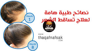 نصائح طبية لعلاج تساقط الشعر من عيادة دكتور أوز ثقف نفسك