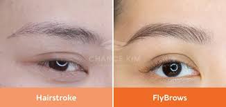 3 Rủi ro khi hairstroke da dầu [NHẤT ĐỊNH PHẢI BIẾT]