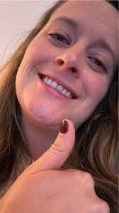 Faces of Neurofibromatosis