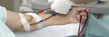 Stark erhöhte werte für serumkalium (> 6, dass die nierenwerte über oder unter diesen werten liegen, der aus dem kreatinin im blut, sobald die nieren versagen und es zu. Dialysetherapie Planung Und Zusammenarbeit Bei Chronischer Niereninsuffizienz Enorm Wichtig Medical Tribune