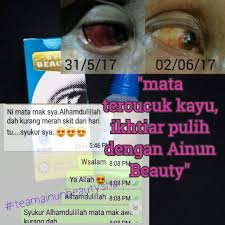 Obat sakit mata karena ngelas obat sakit mata ampuh sore dok saya mau tanya untuk obat mata tips mencari obat sakit mata tradisional yang ampuh obat sakit mata menular apakah saat. Ywdo Rwwpxy2vm