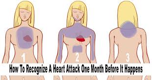 Women are more likely to report this type of symptom than men. How To Recognize The Signs Of A Heart Attack In Advance Davisloaded