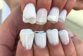 Pero así como es importante para muchas personas estar a la moda con la última tendencia, también es importante conocer las diferentes formas de uñas para para elegir cual va con tu tipo de mano.las uñas en forma de ovalo, van de medianas a largas con lados rectos, los. Unas Decoradas Como Muelas Nueva Tendencia En Redes Rcn Radio