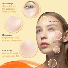 The best dark spot remover products, treatments, and creams that really work to remove dark spots on the face, including drugstore formulas for all skin tones. Firstsun Freckle Face Bleaching Cream To Remove Dark Spots Anti Melasma Acne Treatment Skin Lightening Hyperpigmentation Cream Facial Self Tanners Bronzers Aliexpress