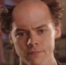 Bald Harry Styles Funny Harry Styles Memes Harry Styles Photos
