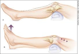 Orthopedic tools web pages vector illustration. Acute Knee Injuries Use Of Decision Rules For Selective Radiograph Ordering American Family Physician