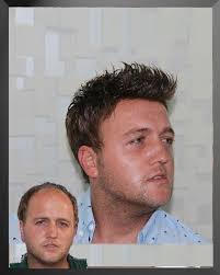 Dunyaca Unlu Sosyal Medyalardan Biri Olan Devpost Adli Sosyal Medya Sitesi Araciliyla Firmamizda Islemlerinizi Yapmis Oldugumuz Protez Sac Sac Urunleri Unluler