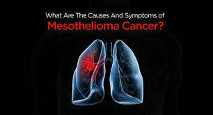 Maybe you would like to learn more about one of these? Mesothelioma Symptoms Causes Diagnosis Treatment