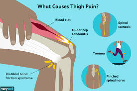 There are four ligaments in the knee that are prone to injury: Thigh Pain Causes Treatment And When To See A Doctor