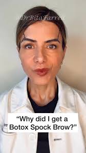 The frontalis muscle has different morphologies in different people. In  many patients, its fibers extend lateral to the temporal fusion line. When  the forehead is only treated between the fusion ...