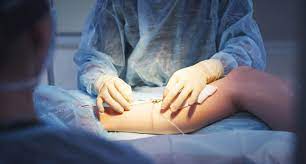 Periphere Arterielle Verschlusskrankheit Symptome Diagnose Therapie