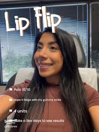 Understanding the Lip Flip Procedure: My Experience