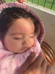 Hi mommies My baby has small small red pimples type bumps