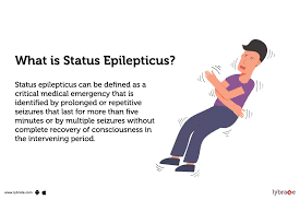 Image result for Status Epilepticus