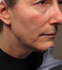 Clinical Casebook M22™ Treatments