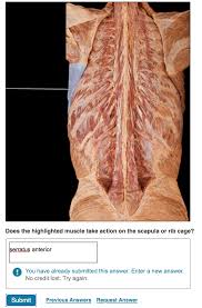 If the rib cage pain is due to a minor injury, such as a pulled muscle or bruise, you can use a cold compress on the. Solved Does The Highlighted Muscle Take Action On The Sca Chegg Com
