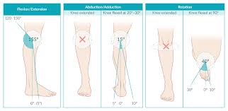 Knee injuries commonly occur to athletes who engage in high intensity sports and this may cause pain and inflammation of the joint. Knee Ligament Injuries Amboss