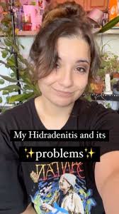 Hello! Since my last post, i've gotten quite a few messages from people  asking about triggers and what mine are! Triggers are certain aspects that  “trigger” flares and outbreaks of your illness.