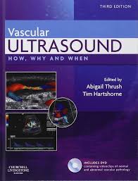 Vascular Ultrasound: How, Why and When