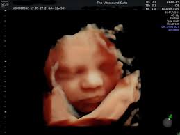 Each ultrasound scan tells a different pregnancy and parenting journey. 3d 4d Scan The Ultrasound Suitethe Ultrasound Suite