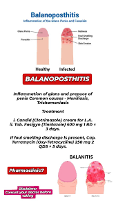 Image result for balanoposthitis