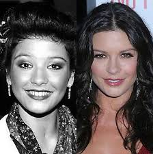 Making a plastic mold can be done in a few steps if you want to make copies of an existing object, according to bright hub engineering. Celebrity Plastic Surgery Before And After Celebrity Surgery Celebrity Plastic Surgery Plastic Surgery