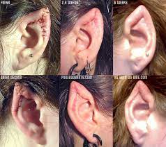Spock… or santa's elves… or the movie elf, starring will ferrell… or the lord of the rings trilogy… or avatar, but the mainstream popularity and fascination with elves has created the newest cosmetic surgery craze. Ear Pointing Bme Tattoo Piercing And Body Modification News