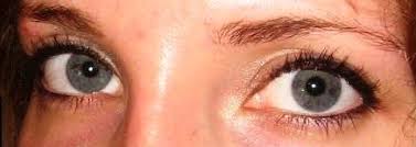 Tlak v oku alebo pocit tlaku v oku je tlak, ktorý cíti človek v oku, ale aj za okom. Ocni Pigmentace