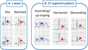 Image result for J Wave