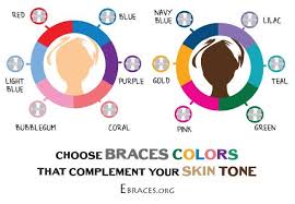 you dont have to be a genius to choose braces colors