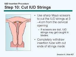 If you have questions about how the iud device works, along with what you should and shouldn't freak out about after insertion, here's a guide where everything is spelled out in one place. Copperbearing Intrauterine Devices Iuds Session Iv Practicing Iud