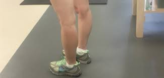 Image result for Hypermobility Signs