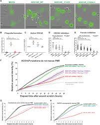 Highly regarded firm zaid ibrahim & co (a member of zico law) has a sound reputation in the market, particularly for financing, capital markets and corporate work. Recessive Nos1ap Variants Impair Actin Remodeling And Cause Glomerulopathy In Humans And Mice Science Advances