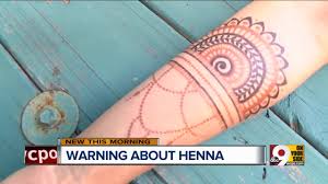 We know our business and promise to provide you the best results around. Mother Shares Warning After Black Henna Tattoos Left Children Scarred For Life