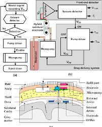 proposed closed loop drug delivery system a block diagram