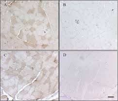 Learn how many recessed lights you need. Tlr4 As Receptor For Hmgb1 Induced Muscle Dysfunction In Myositis Annals Of The Rheumatic Diseases
