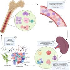 Image result for Hematologic Cancer